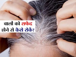 सफेद बालों को फिर से काला कर देते हैं ये 12 उपाय, जानिए क्यों होता है कम उम्र में बाल सफेद
