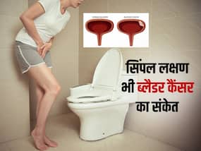 पेशाब करते समय ये 5 लक्षण हो सकते हैं ब्लैडर कैंसर का संकेत, इग्नोर किया तो आ सकती है ऑपरेशन की नौबत