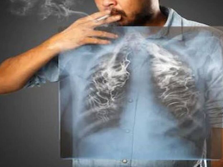 सिगरेट पीने से बढ़ सकती है ये लाइलाज बीमारी, जानें धूम्रपान के गम्भीर नुकसान