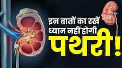 Kidney Stone: पथरी से बचने के लिए इन बातों का ख्याल रखें, Watch Video