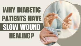 Diabetes: Reasons Why Diabetic Patients Have Slow Healing