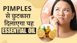 Skin Care Tips: Pimples से छुटकारा दिलाएगा Lemon Essential Oil,स्ट्रेस भी होगा कम