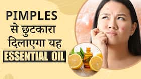 Skin Care Tips: Pimples से छुटकारा दिलाएगा Lemon Essential Oil,स्ट्रेस भी होगा कम