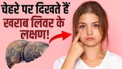 Liver Disease Symptoms: Liver खराब होने पर चेहरे पर दिखते हैं ये लक्षण, देखें ये Video