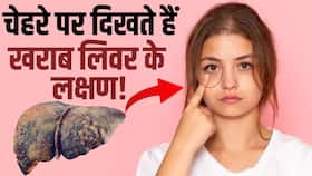 Liver Disease Symptoms: Liver खराब होने पर चेहरे पर दिखते हैं ये लक्षण, देखें ये Video