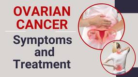 Ovarian Cancer: Identifying the Symptoms and What to Expect!