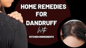 Dandruff Remedy: Complete Dandruff Removal Using Homemade Ingredients