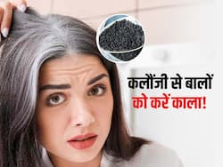 सफेद बालों की समस्या को जड़ से खत्म कर सकता है कलौंजी का बीज, इस तरह करें इस्तेमाल