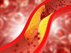 बैड कोलेस्ट्रॉल को कम करें किचन में रखें ये मसाले