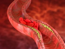 Bad cholesterol कम करने के लिए एक्सपर्ट्स ने बताई ये 3 घरेलू टिप्स, दवाएं ही नहीं इन तरीकों से कम होगा एलडीएल