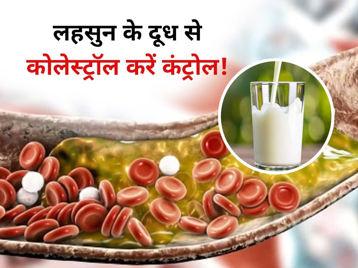 lahsun aur dudh khane ke fayde garlic with milk for Cholesterol नसों की दीवरों में चिपके