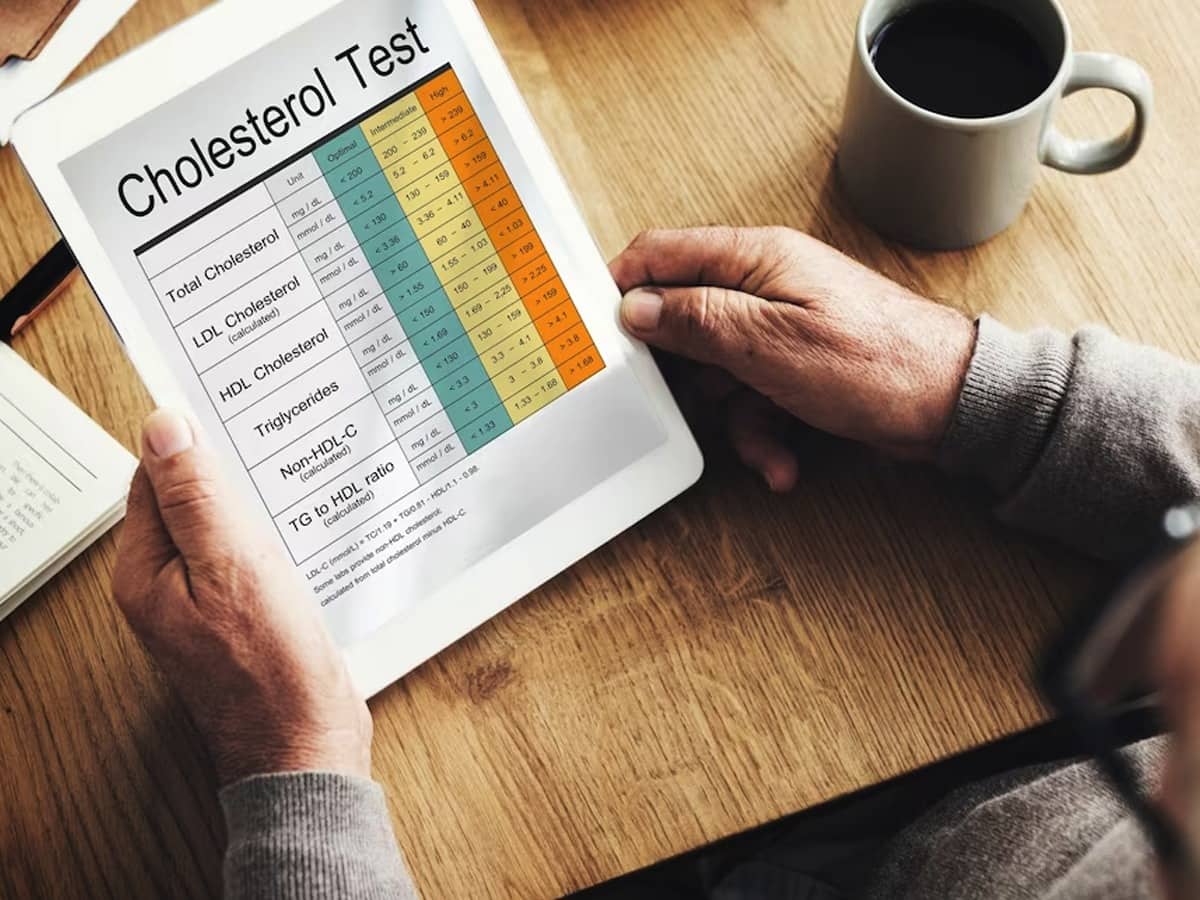 Cholesterol Test In Hindi Cholesterol Test Karne Ka Tarika