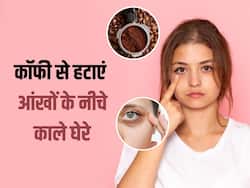 कॉफी से हटाएं आंखों के नीचे काले घेरे, इन 3  तरीकों से करें इस्तेमाल