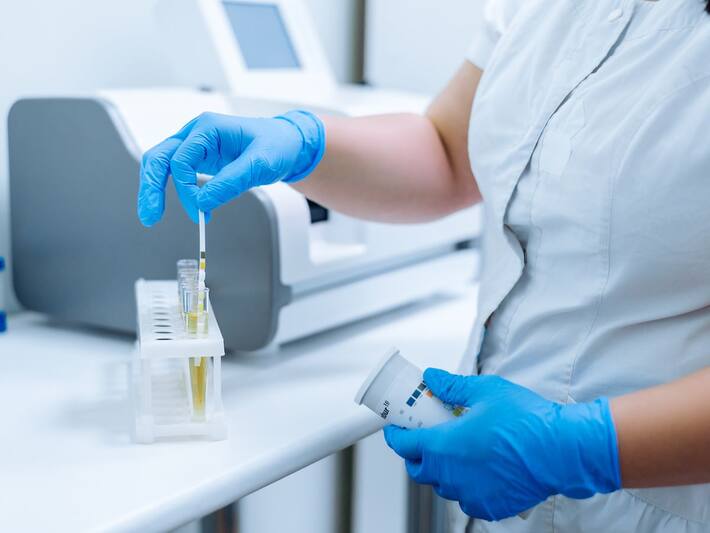 Dark Coloured Urine and 5 Other Toilet Symptoms That Could Be Signs of