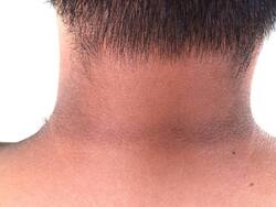 काली गर्दन को 10 मिनट में साफ करने के लिए अपनाएं ये 3 घरेलू नुस्खे, 1 बार में एप्लाई करने से दिखेगा फर्क