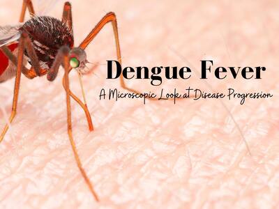 Dengue Infection: What Happens To Your Body If You're Infected By The Dengue Virus?