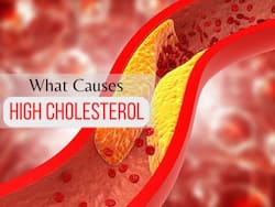High Cholesterol Causes: 7 Unusual Things That Can Raise Your Bad Cholesterol Levels