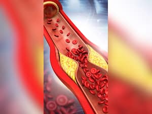 10 Empty Stomach Juices To Lower Your Bad Cholesterol Levels Naturally