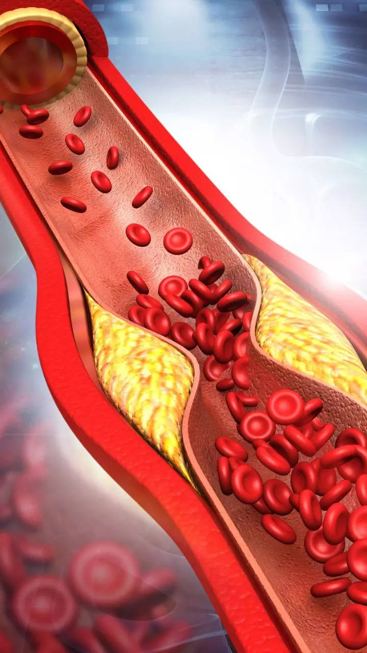 10 Empty Stomach Juices To Lower Your Bad Cholesterol Levels Naturally