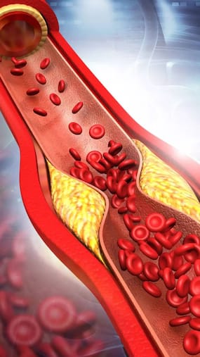 10 Empty Stomach Juices To Lower Your Bad Cholesterol Levels Naturally