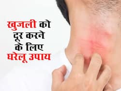 खुजली से है परेशान, तो दूर करने के लिए अपनाएं ये घरेलू उपाय, 1 से 2 इस्तेमाल में ही मिलेगा आराम