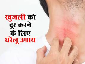 खुजली से है परेशान, तो दूर करने के लिए अपनाएं ये घरेलू उपाय, 1 से 2 इस्तेमाल में ही मिलेगा आराम