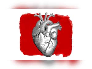 Ignoring Heart Health? BEWARE! It Can Increase Stroke Risk