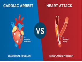 Is It a Heart Attack or Sudden Cardiac Arrest? 7 Warning Signs Your Heart Is In Trouble Is It a Heart Attack or Sudden Cardiac Arrest? 7 Warning Signs Your Heart Is In Trouble