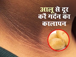 आलू की मदद से मिनटों में दूर करें गर्दन का कालापन, जानें इस्तेमाल के 3 तरीके