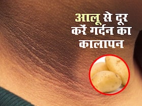 आलू की मदद से मिनटों में दूर करें गर्दन का कालापन, जानें इस्तेमाल के 3 तरीके