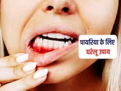 दांतों में जमा पायरिया से हैं परेशान? इन 5 घरेलू उपायों से जल्द दूर होगी दिक्कत
