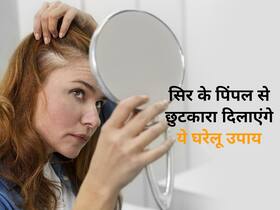 Hair Care Tips : सिर के मुंहासों से है परेशान तो अपनाएं ये आसान घरेलू उपाय समस्या का होगा समाधान Hair Care Tips : सिर के मुंहासों से है परेशान तो अपनाएं ये आसान घरेलू उपाय समस्या का होगा समाधान