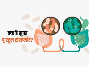 आपके मल से हो सकता है आंत और लिवर जैसी गंभीर बीमारियों का इलाज, जानिए क्या है सुपर पू स्टूल ट्रांसप्लांट आपके मल से हो सकता है आंत और लिवर जैसी गंभीर बीमारियों का इलाज, जानिए क्या है सुपर पू स्टूल ट्रांसप्लांट