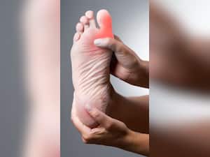 10 High Uric Acid Symptoms In Fingers And Toes