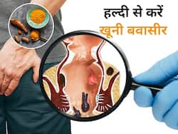 खूनी बवासीर का इलाज कर सकता है हल्दी, दर्द और सूजन से राहत पाने के लिए ऐसे करें इस्तेमाल