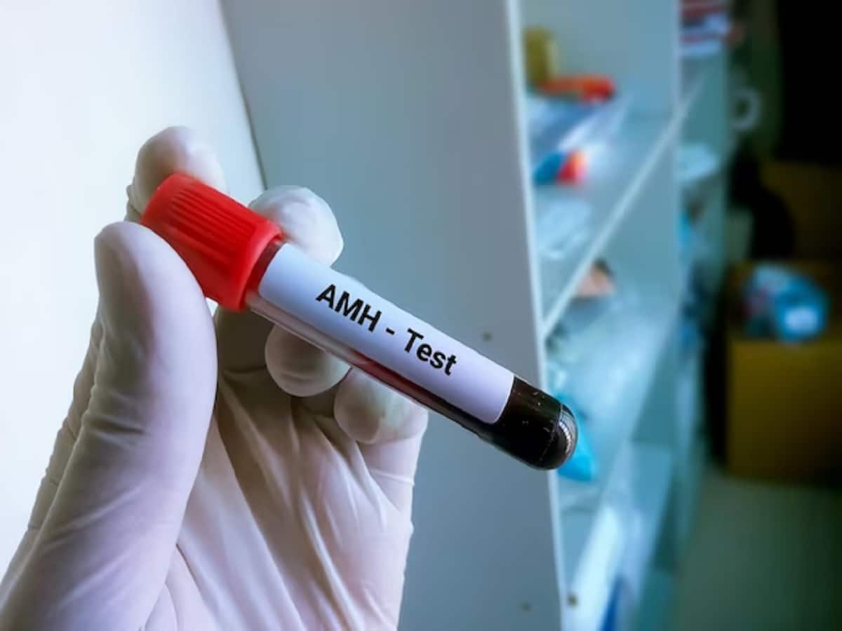 Female Fertility What is AntiMullerian Hormone And When AMH Test Is