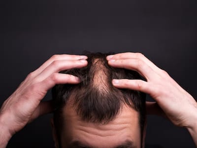 Stress and Hair Loss: Understanding the Link