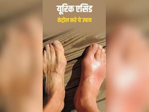 यूरिक एसिड कंट्रोल करने के आसान से उपाय