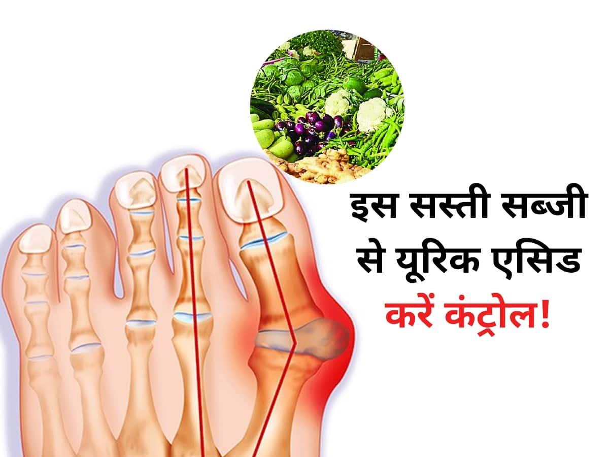 Bitter Gourd For Uric Acid 10 रुपये किलो के भाव से बिकने वाली इस सब्जी से खून में नहीं बढ़ेगा