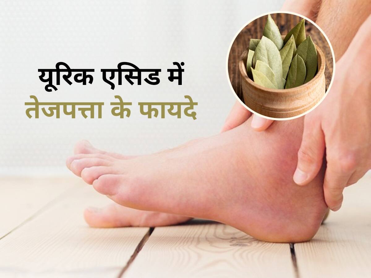 Uric Acid Me Tejpatta Ke Fayde Uric Acid Ka Upchar जोड़ों में जमा यूरिक एसिड पिघलाकर बाहर