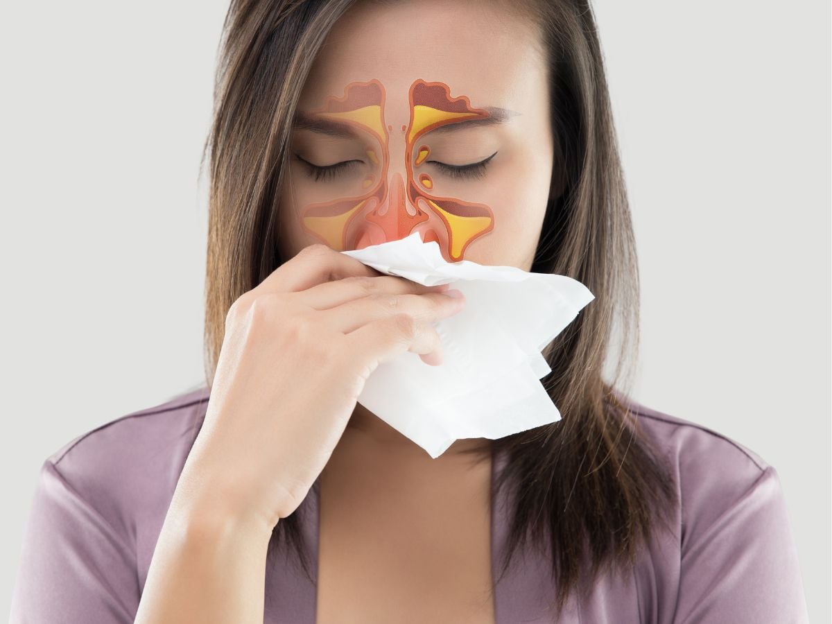 What Is Sinusitis