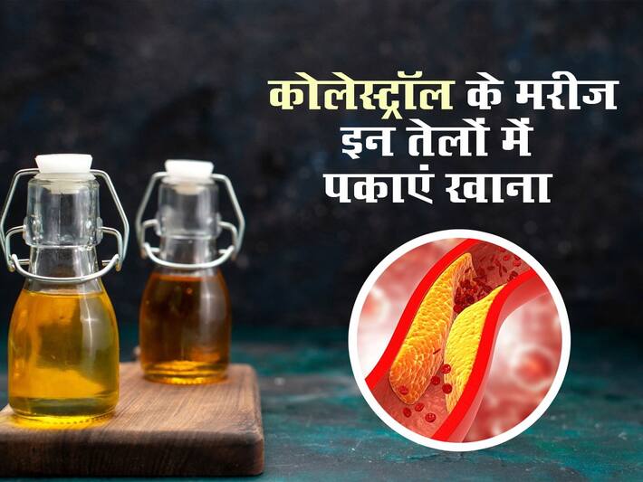 हाई कोलेस्ट्रॉल के मरीज साधारण तेल में बिल्कुल न पकाएं खाना, जानें Bad
