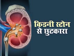 किडनी स्टोन के खतरे से बचने के लिए आज ही अपनी डाइट मे शामिल करे ये फूड्स
