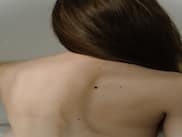 Natural Ways To Remove Moles, Warts, Blackheads, Skin Tags, And Age Spots