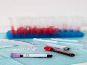 Five Benefits Of Liquid Biopsy