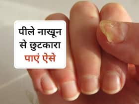 Yellow Nails: नाखून पीले होने पीछे क्या है कारण? जानिए इन्हें साफ करने के आसान उपाय