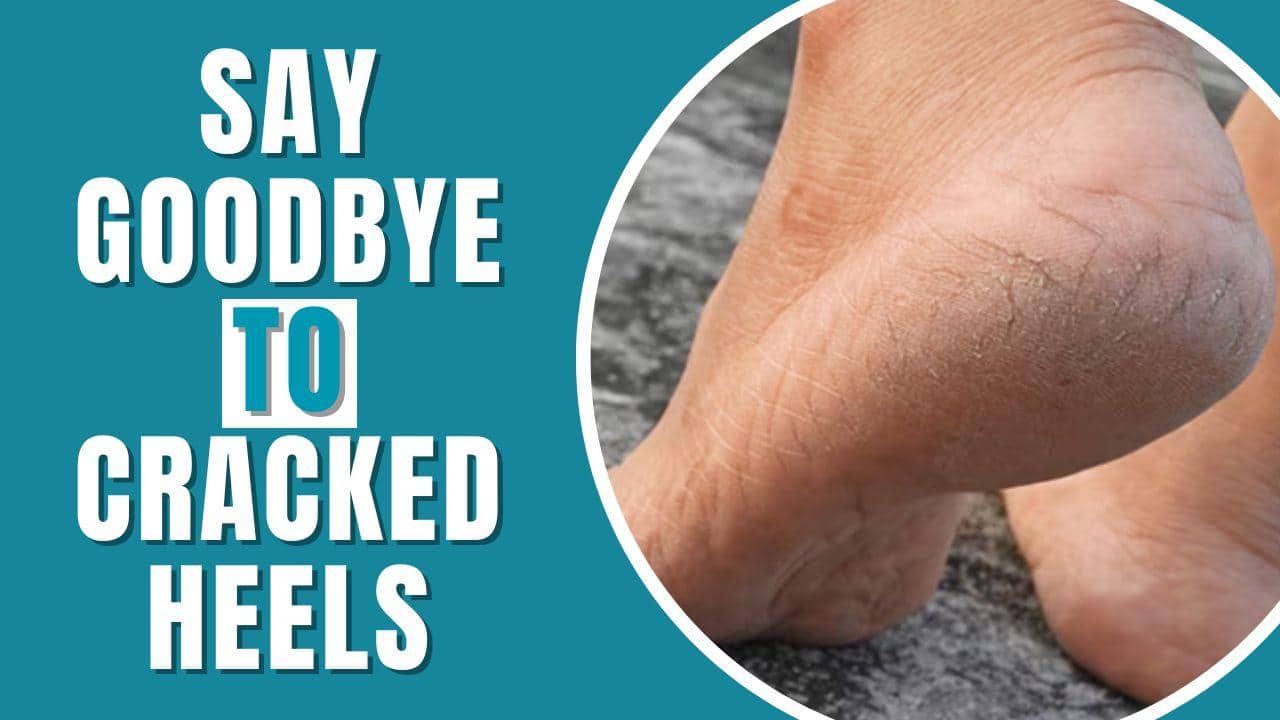 Say goodbye to cracked heels! Know prevention tips and home remedies to get smooth feet | TheHealthSite.com