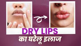 Dry Lips Remedies: होंठ फटने की दिक्कत हो तो इन घरेलू नुस्खों को अपनाएं