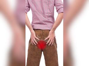 10 Early Sings and Symptoms of Haemorrhoids or Piles