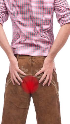 10 Early Sings and Symptoms of Haemorrhoids or Piles